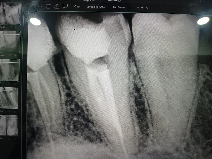 Pooja Smile Care Dental Gallery Image 35